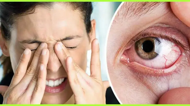 Dry-Eyes-Permanently